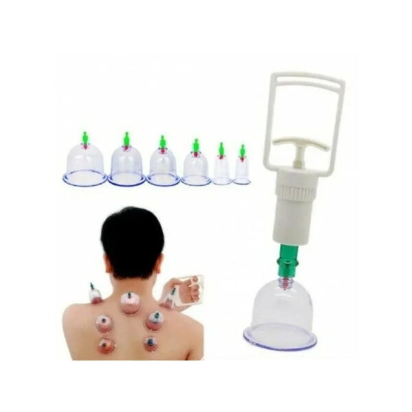 DYKL Θεραπευτική συσκευή με βεντούζες 6τεμ. - Vacuum aparatus